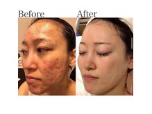 ジェニックサロン グランドギンザ ひたちなか(GENIC SALON GRAND GINZA)/ 日本一の肌改善サロンの実力