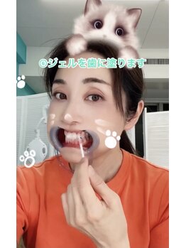 ホワイトニングビューティー 名古屋栄店(WHITENING BEAUTY)/セルフホワイトニング
