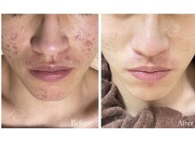 サロン バイオビオ(SALON BioBio)/