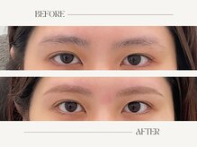 ナキ 富山店(Naki)/眉毛施術例 (眉毛Before.After)