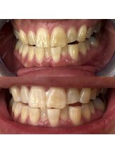 シエル 美里店(ciel)/セルフホワイトニング