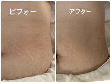 ノーブル シャット Noble Chate/お腹集中ケア