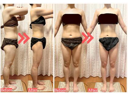 ラナンスパ(RANUN SPA)の写真