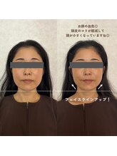 ウーマンビーヘルス(woman Be Health)/オーダーメイド美容鍼灸90分