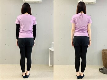 イレ 名古屋栄(ile)/ドレスが映える「美背中」へ。