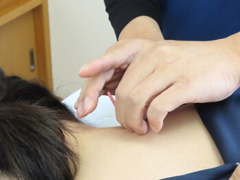 はやかわ鍼灸整骨院/日頃の不調改善にオススメ♪