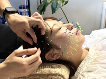 ハリキュア 仙台店(Haricure)の写真/【美容だけでなく、身体の土台から整える美容鍼】
