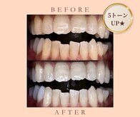 ルセホワイト 室蘭登別(LUCE WHITE)