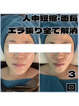 アンドワイ バイ サロンリーナ(&y by Salon Lena)/【コルギを超えたコルゾウ×光】