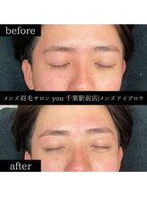 ユー 千葉駅前店(you)/ビフォ－アフター写真