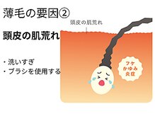 サロン ド エステティック ルチア 東京店/頭皮の肌荒れ