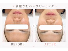 パールプラス 那須塩原黒磯店(Pearl plus)/じっくり肌育☆トーンアップ◎