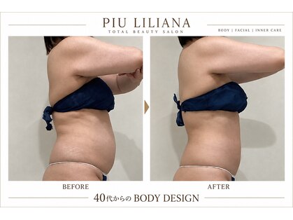 ピュウリリアーナ(Piu liliana)の写真