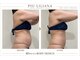 ピュウリリアーナ(Piu liliana)の写真