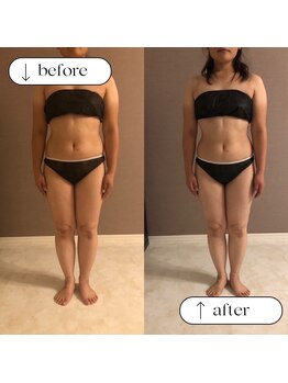 トータルビューティーサロンリア(Li'a)/ビフォー＆アフター