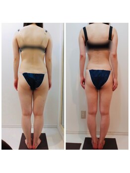 アイディエム 新宿店(IDM)/【モニター】165ｃｍ・20代