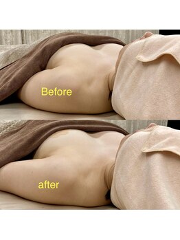 ベッピン(Beppin)/1回/バストアップ/ブライダル