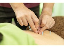 アスミルはり灸接骨院 春岡通店の雰囲気(肩こり、腰痛、頭痛、自律神経などにもアプローチできます。)