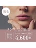 【メンズ】つるつる！ヒゲ脱毛