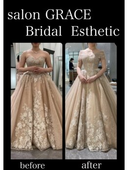 サロン グレイス(salon GRACE)/