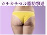 【何をしても痩せない方】VL痩身カチカチセル脂肪分解デトックスMパーツ