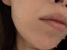 ディアナ 代々木上原(_Diana)/グリーンピール/Diana代々木上原