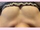ふわり 佐伯店(fuwari)の写真/【リピーター様多数！バストアップ成功者続々！】次はあなたが叶える番です◎まずはご相談ください♪
