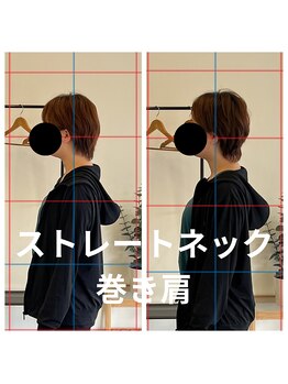 熊本カワル整体 JR上熊本駅院/ストレートネック・巻き肩