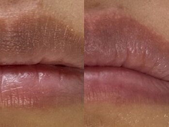 フェリス(FELIZ)/韓国発ルメラ