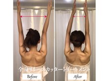 リノ(Lino)/全身リリースカッターB&A