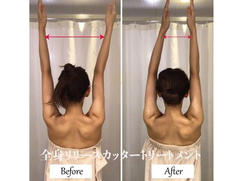 リノ(Lino)/全身リリースカッターB&A