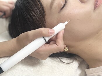 ユウドット(yuu.)の写真/今年頑張った自分へのご褒美に♪美容液導入付き本格シミケア☆都度払い可能＆当て放題で根本改善へ！