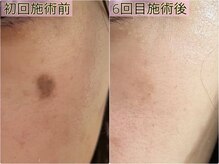 ル ボヌールの雰囲気(最新光マシーン新たに導入♪スピーディーな結果出しを目指します)