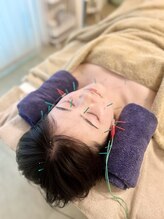 めい鍼灸院/小顔　二重顎　ほうれい線ケア◎