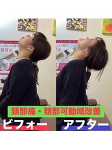 ヒデ整体院(Hide整体院)/産後骨盤矯正で歪み腰痛開き改善