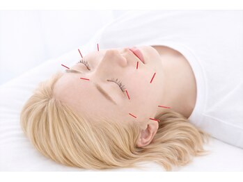 グレース鍼灸院 整骨院 ひたちなかの写真/《効果重視の方◎》お顔の悩みは【美容鍼】で解決!肌質改善/リフトアップ/むくみ解消◎美容鍼初回￥4400