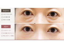 トウゲンキョウの雰囲気（目元のたるみにも幹細胞フェイシャル☆）