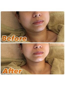 骨盤整体 美々/フェイシャルエステ