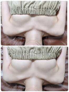 ビープラス(B+)/上:before 下:after