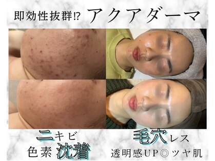 ココンフワット(Coconfouato)の写真