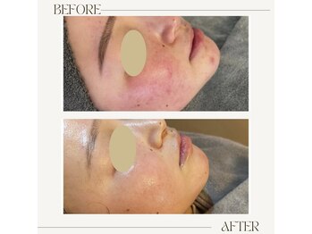 アンド(&.)/before/after