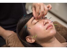 ファノーバ 奥沢店(FUNOVA)/整体/マッサージ/鍼灸/骨格矯正