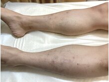 リベル 名古屋(Lebelle:)/ハーブピーリング専門名古屋