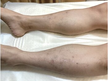 リベル 名古屋(Lebelle:)/ハーブピーリング専門名古屋