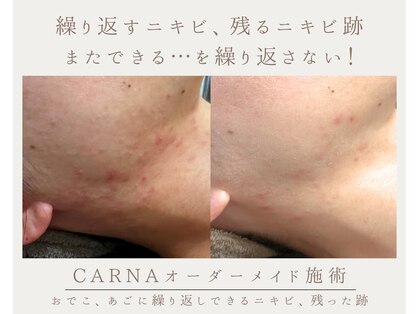 カルナ(CARNA)の写真