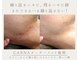 カルナ(CARNA)の写真