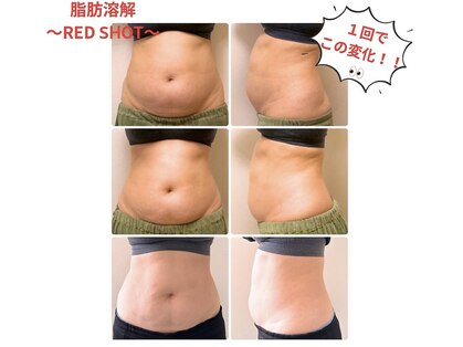 サロン ミノリ(salon MINORI)の写真