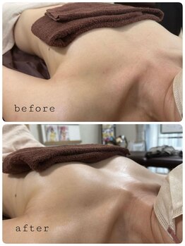 ナチュラ(Natura)/バザルトバストケア!