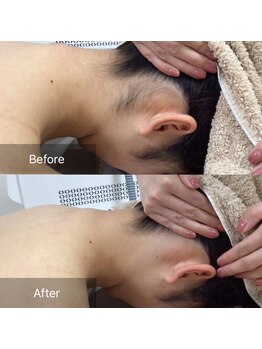 アルゴ 八幡黒崎店(ALGO)/初回のbefore、after