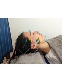 鍼灸施術を受けたい